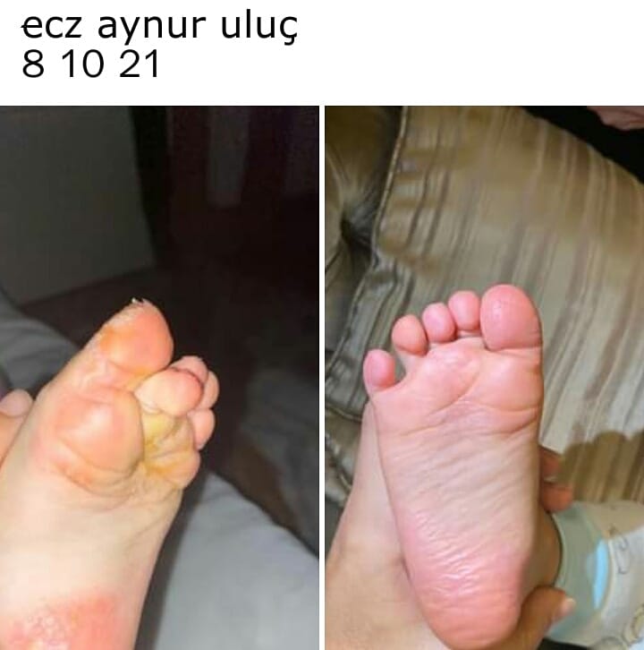 Dermatoloji uzmanı Doç. Dr. Gökhan Okan