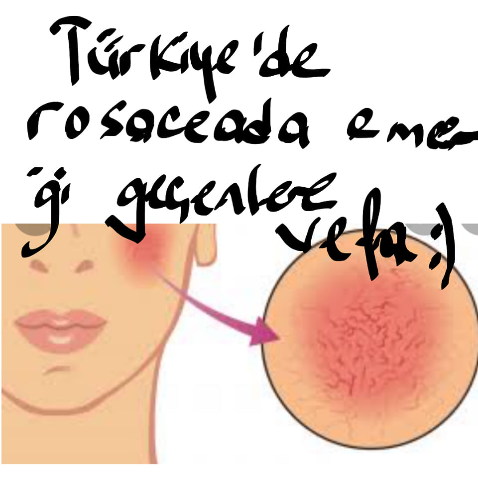 Rosacea emekçilerine vefa